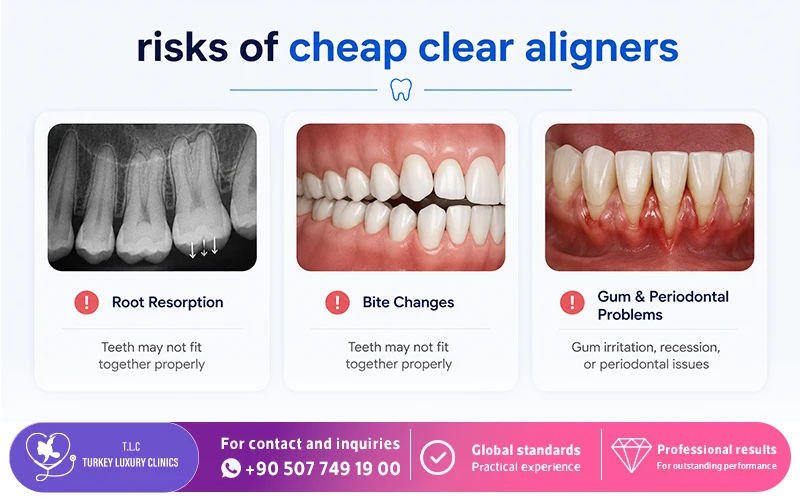 What Are the Risks of Cheap Aligners?