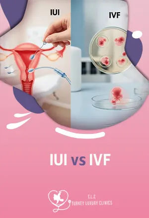 IUI vs IVF: Diferencias Clave, Tasas de Éxito, Costo y Cuál es Mejor