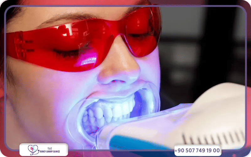 تجميل الأسنان الأمامية في تركيا لاكشري كلينك