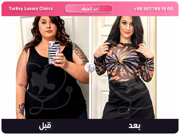 العوامل المؤثرة على سعر ابر اوزمبك العوامل المؤثرة على سعر ابر اوزمبك