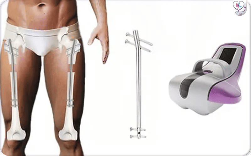 What is the Precice MAX System?