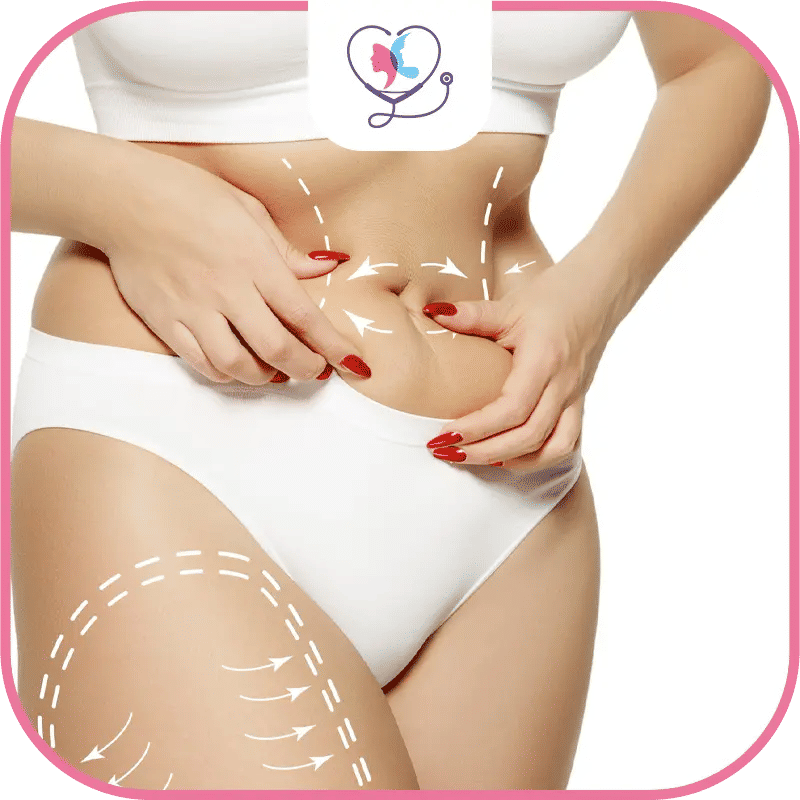 الفرق بين شفط الدهون ونحت الجسم