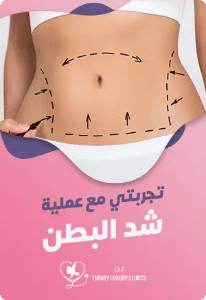 تجربتي مع عملية شد البطنfeatured image