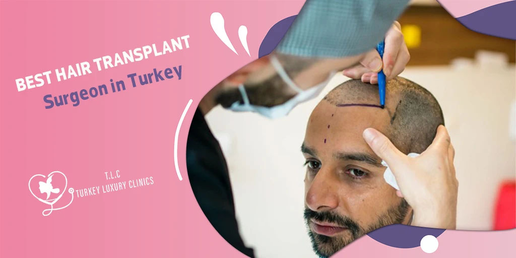 Best Hair Transplant Surgeon in Turkey: Leading Expert in DHI, FUE & Stem Cell Therapy
