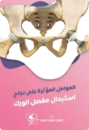 العوامل المؤثرة على نجاح استبدال مفصل الوركfeatured image