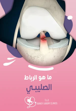 الرباط الصليبي: ما هو؟ وما هي الأعراض والأسباب؟featured image