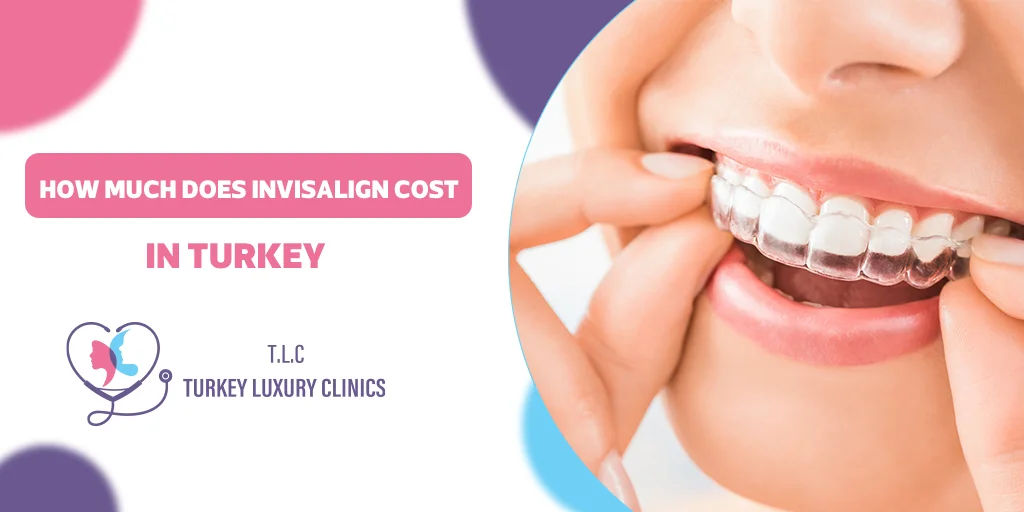 How Much Does Invisalign Cost in Turkey? 2026 Prices and Packages