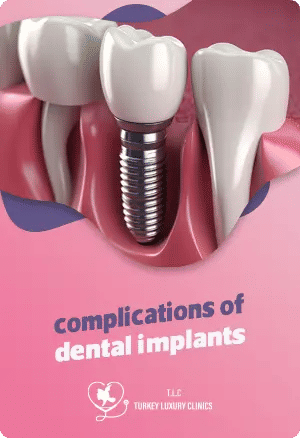 Addressing Concerns: Managing Potential Risks and Complications of Dental Implants