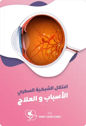 اعتلال الشبكية السكري: الأسباب، الأعراض والعلاجfeatured image