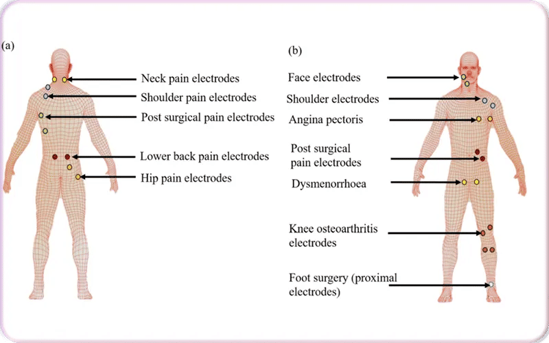 How to Use a TENS Unit Safely and Effectively on the Face?