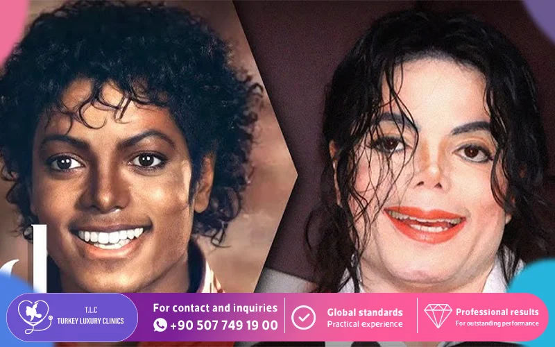 Why Did Michael Jackson Get Nose Surgery?