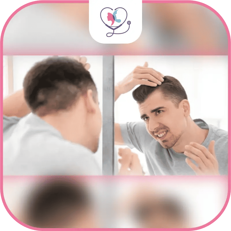 Hair Transplant Best Age