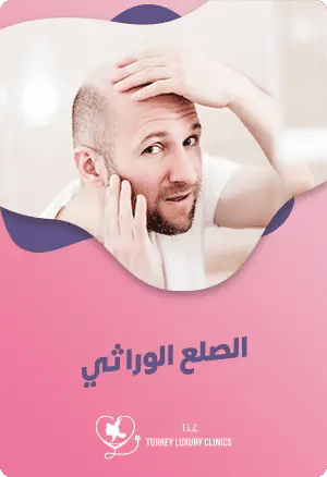 تعرف على علاج الصلع الوراثي في تركياfeatured image