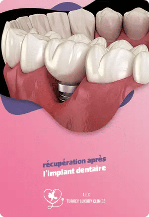 Convalescence après un implant dentaire