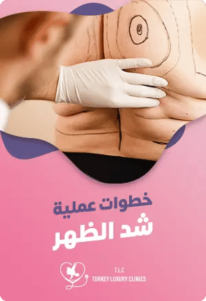 خطوات عملية شد الظهر: تعرف عليهاfeatured image