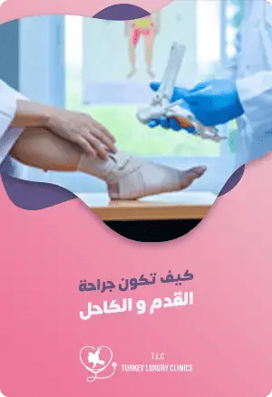 كيف تكون جراحة القدم والكاحل في تركيا؟featured image