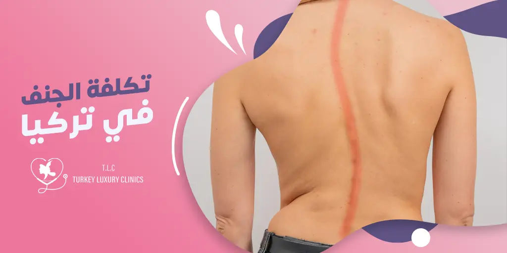 تكلفة جراحة الجنف في تركيا - الأسعار والتفاصيل