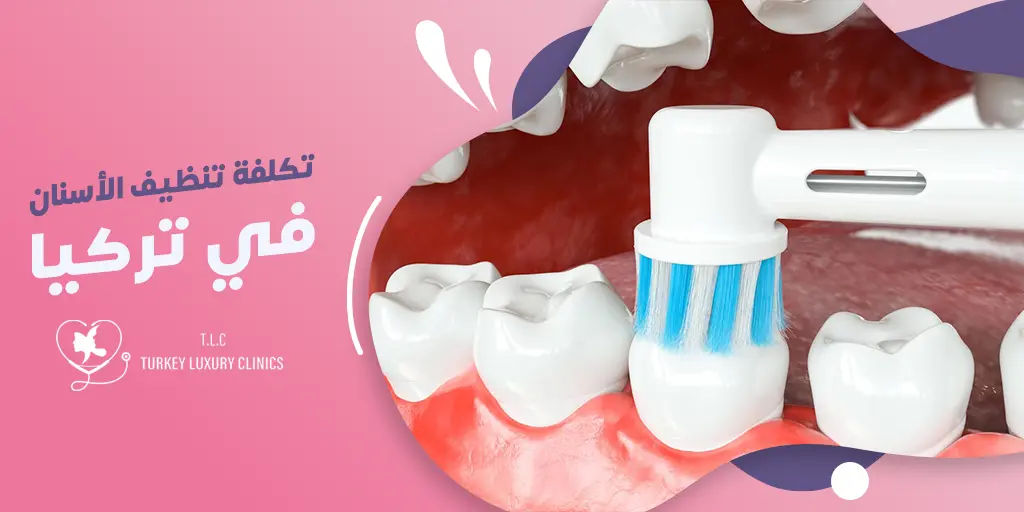 أسعار تنظيف الأسنان في تركيا