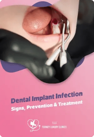 Dental Implant Infection: Signs, Prevention & Treatment