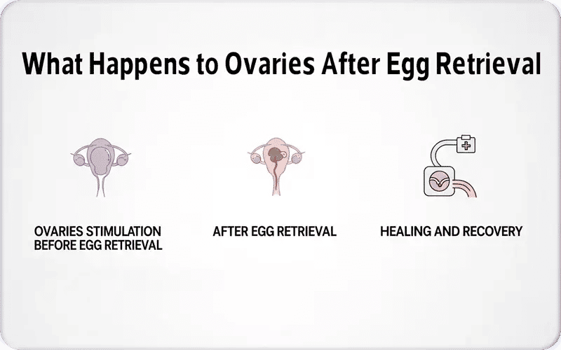 What Happens to Ovaries After Egg Retrieval