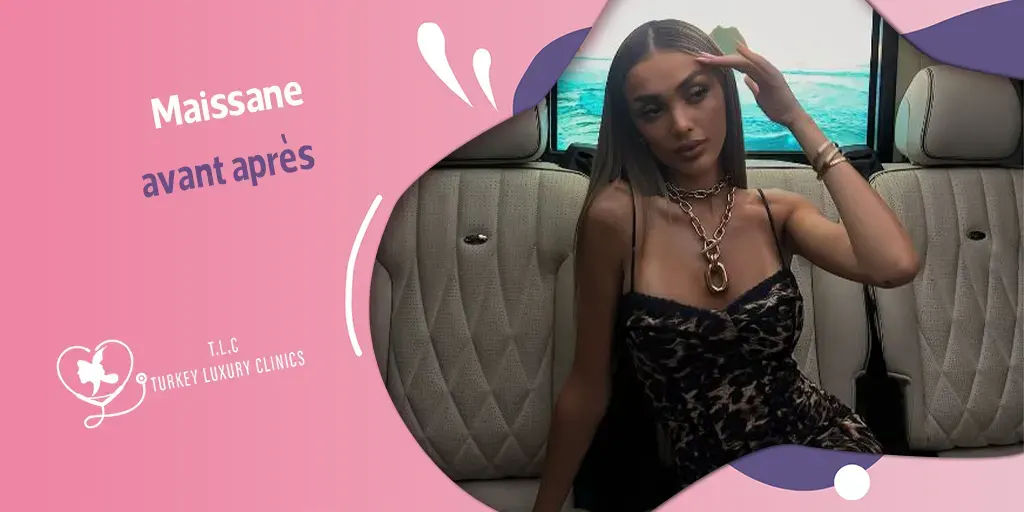 Maissane avant après : une transformation qui intrigue les fans de télé-réalité