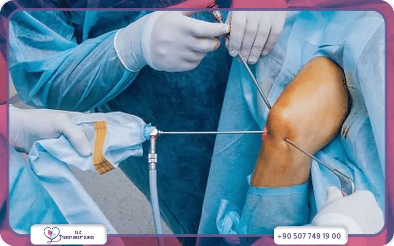 ماذا يحدث عند تأخير تشخيص إصابة الرباط الصليبي؟