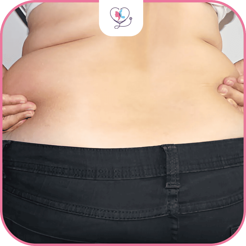 ما هي عملية شد الظهر العمودي؟