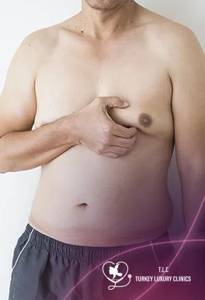 Gynecomastia Surgery Cost Turkey: Full 2026 Breakdown