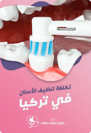 أسعار تنظيف الأسنان في تركياfeatured image