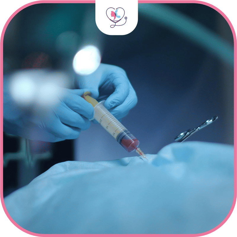 عوامل تحديد خيارات التخدير في شفط الدهون