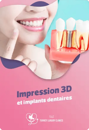 Impression 3D et implants dentaires