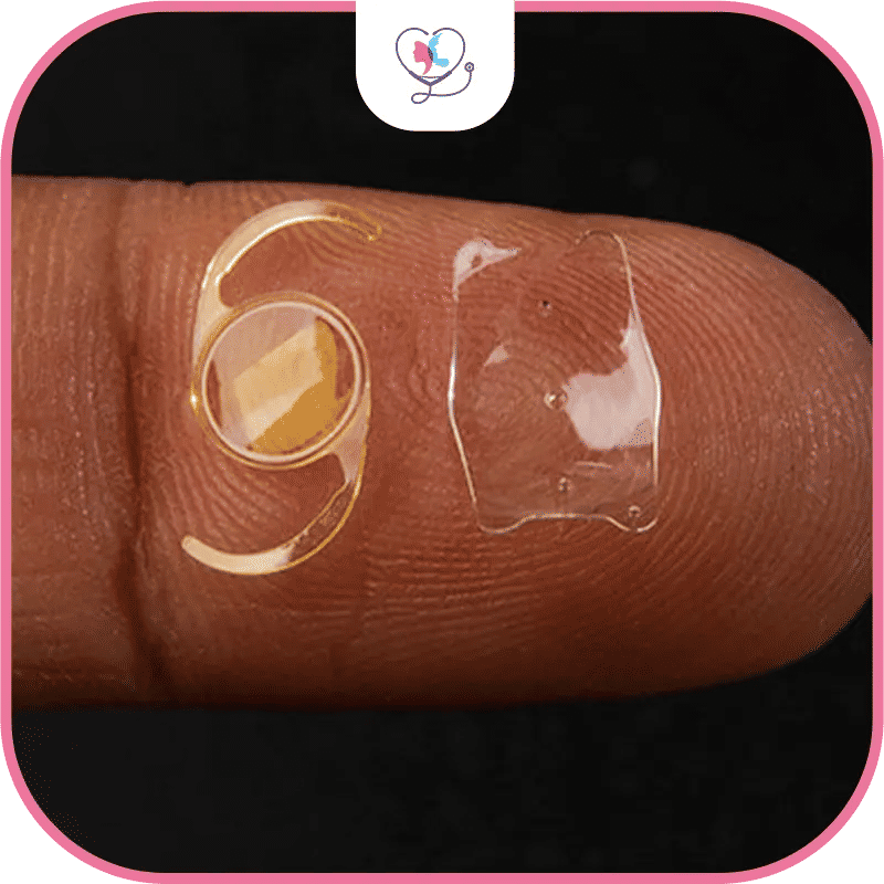 تكلفة زراعة العدسة الذكية في تركيا