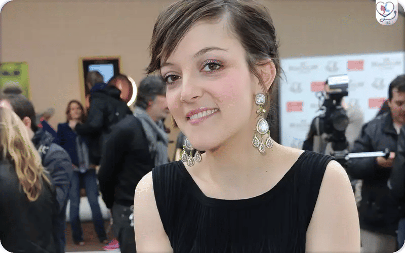 Camille Lellouche a-t-elle fait de la chirurgie esthétique ?