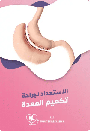 الاستعداد لعملية تكميم المعدةfeatured image