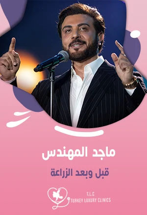 ماجد المهندس قبل وبعد الزراعة: هل تزرع شعراً أم لا؟