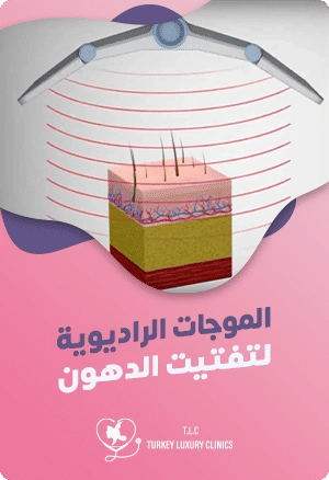 الموجات الراديوية لتفتيت الدهون: كيف تعمل؟featured image