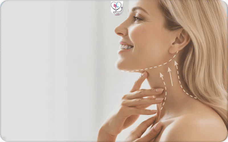 What is a Mini Neck Lift?
