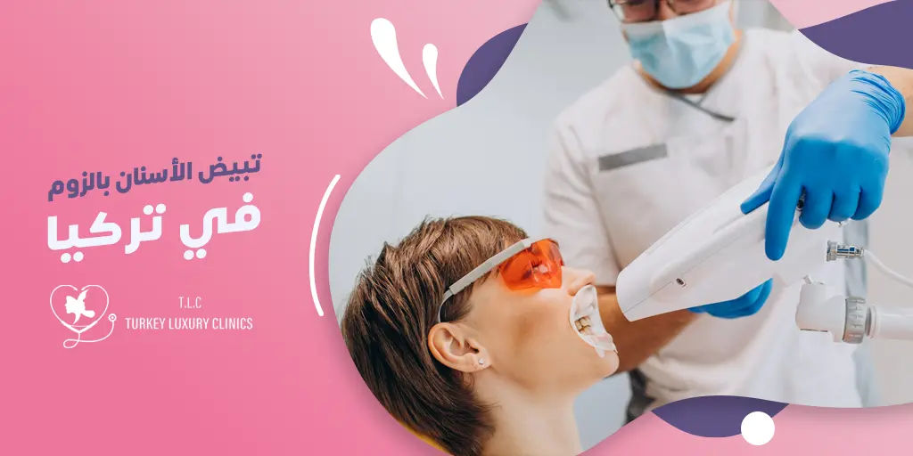 تبييض الأسنان بالزوم في تركيا - دليلك الشامل