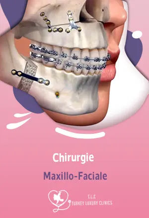 Chirurgie Maxillo-Faciale: traitements, interventions et avantages