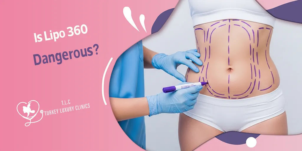 La Liposuzione 360 è Pericolosa? Sicurezza e Rischi