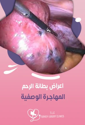 اعراض بطانة الرحم المهاجرة: كيف نساعدك بالعلاج والوقاية؟