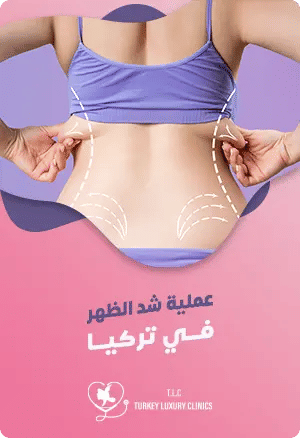 عملية شد الظهر في تركياfeatured image