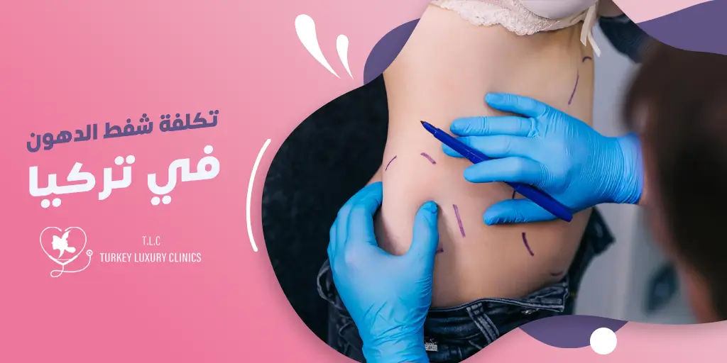 تكلفة شفط الدهون في تركيا: ماذا تشمل والمزايا؟