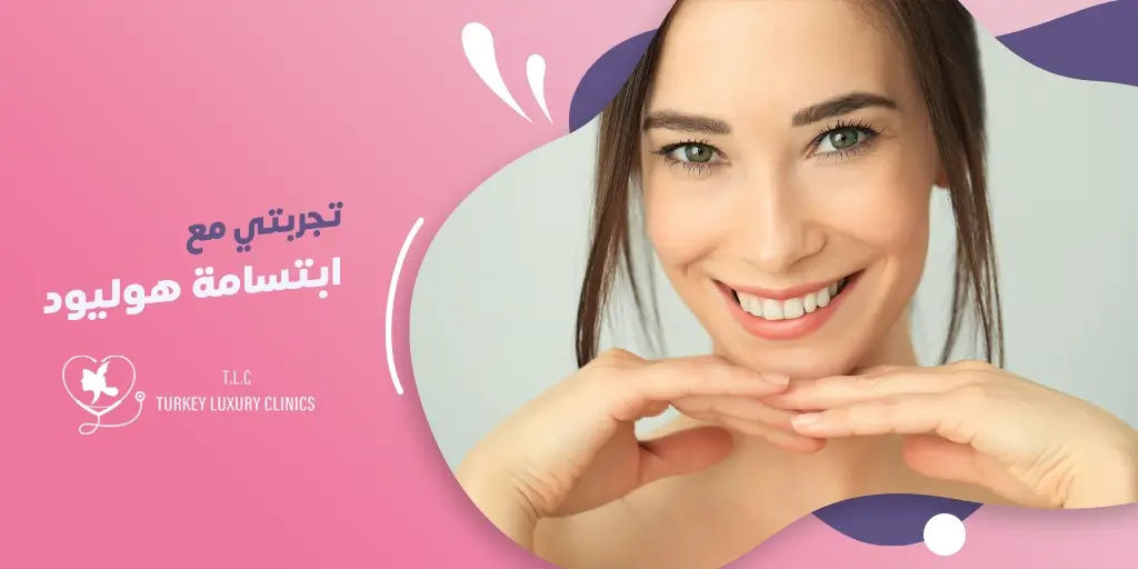 تجربتي مع ابتسامة هوليود 