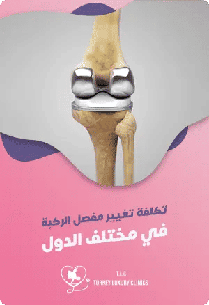 تكلفة تغيير مفصل الركبة في مختلف الدولfeatured image