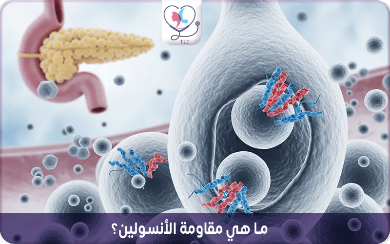 ما هي مقاومة الأنسولين؟