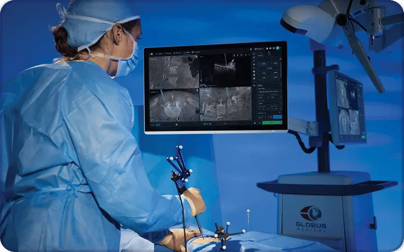 Step by Step Precice Nail Limb Lengthening Surgery