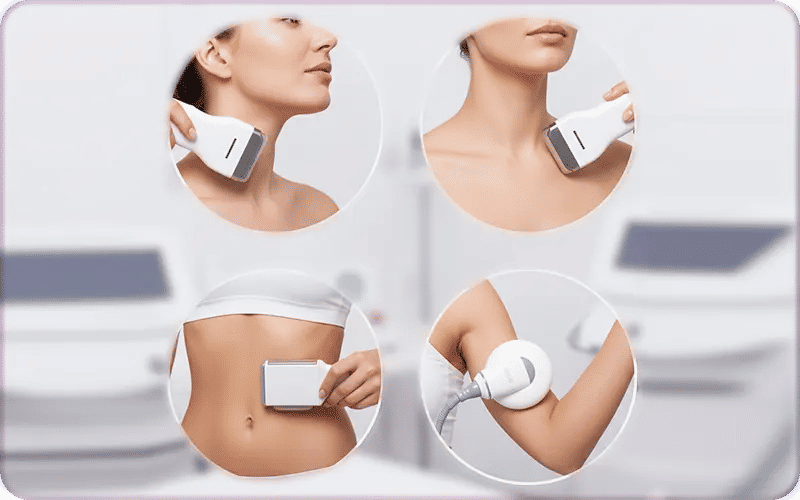 What Is Skin Tightening and Which Body Areas Can Be Tightened?