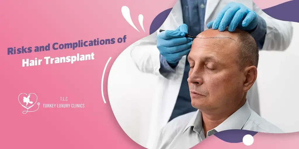 Riesgos y Complicaciones del Trasplante de Cabello