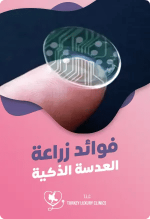 فوائد زراعة العدسة الذكية 